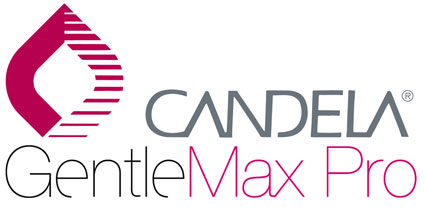 Candela Gentlemax laser treatment