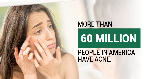 acne treatment options